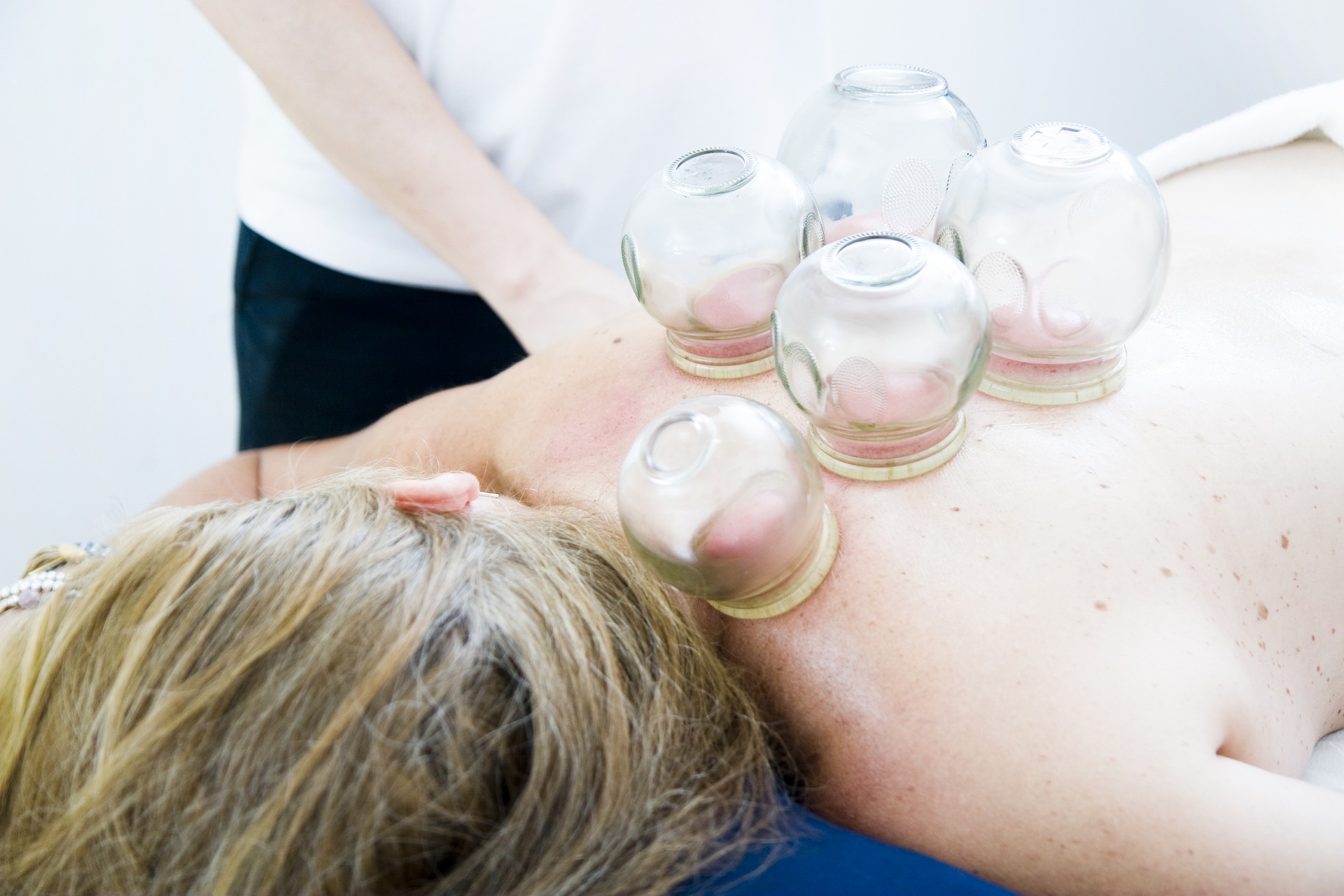 wat is cupping en wat zijn de voordelen?